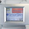 2008 Cynosure Affirm CO2 Smart Skin Laser Skin Rejuvenation Tightening