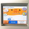 2014 Cynosure SmartSkin CO2 Laser Skin Resurface Wrinkle Ablative - C02 C0 2