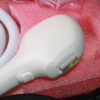Venus Concept Versa SR 515 IPL Skin Rejuvenation 515nm Handpiece Never Used
