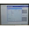 SYNERON 2015 UltraShape Ultrasound Body Contouring Laser Candela Ultra Shape