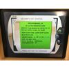 2014 Cynosure SmartLipo Triplex SLT II 1064 1320 1440 Laser Lipolysis Tri Plex