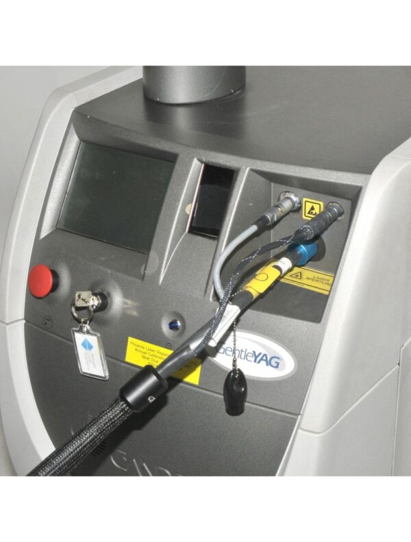 20240926081526-66f5181ebeffd.jpg Candela GentleYAG Mini Nd YAG Laser Gentle YAG 1 Handpiece 12/15/18mm HR 1064nm