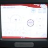 2018 Candela GentleMax Pro Pulsed Laser System 9914-00-9035