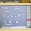 2010 Lumenis M22 IPL Laser System Acne Vascular Skin Rejuvenation