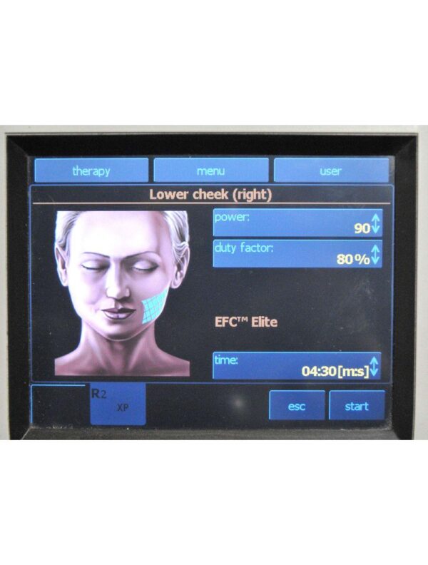2011 BTL Exilis Elite RF Radio Frequency 90 WATT Laser Contour Skin Tightening
