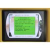 2011 SmartLipo SLT II Triplex w Cellulaze Precision Cynosure Cosmetic Laser