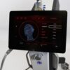 2019 Cutera Ilooda Secret™ RadioFrequency Microneedling RF Wrinkles Scars Aging