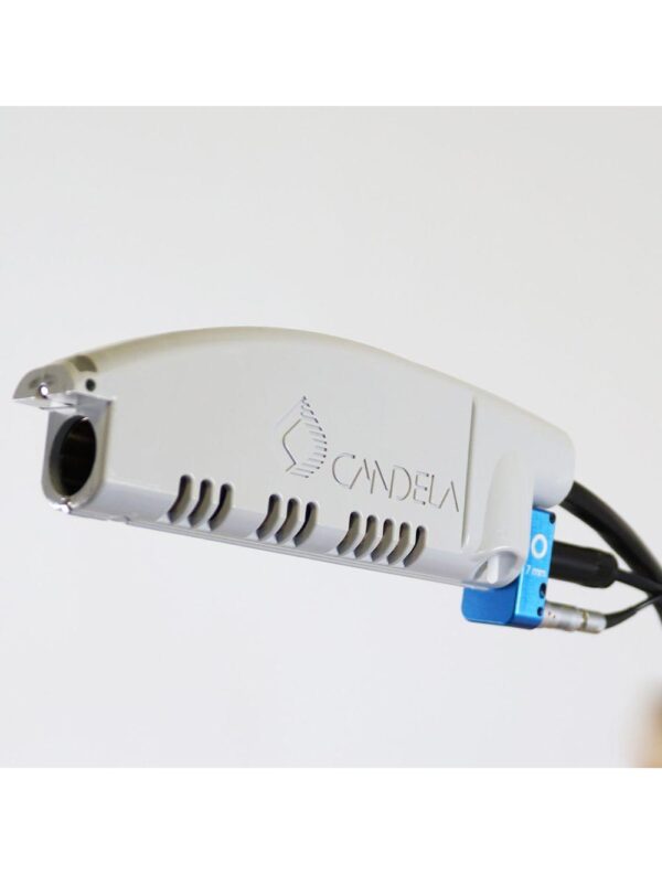 2002 Candela VBeam 595nm Pulsed Dye Laser System PDL Lesions Vascular Wrinkles