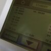 2002 Candela VBeam 595nm Pulsed Dye Laser System PDL Lesions Vascular Wrinkles