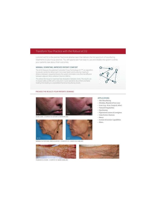 2008 Lutronic Surgical CO2 Laser eC02 Mosaic Skin Fractional Wrinkle Scar Lesion