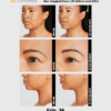 Ulthera Ultherapy DeepSee Transducer DS 10-1.5 (Orange)
